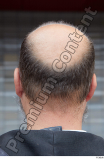 Street  662 bald hair head 0001.jpg